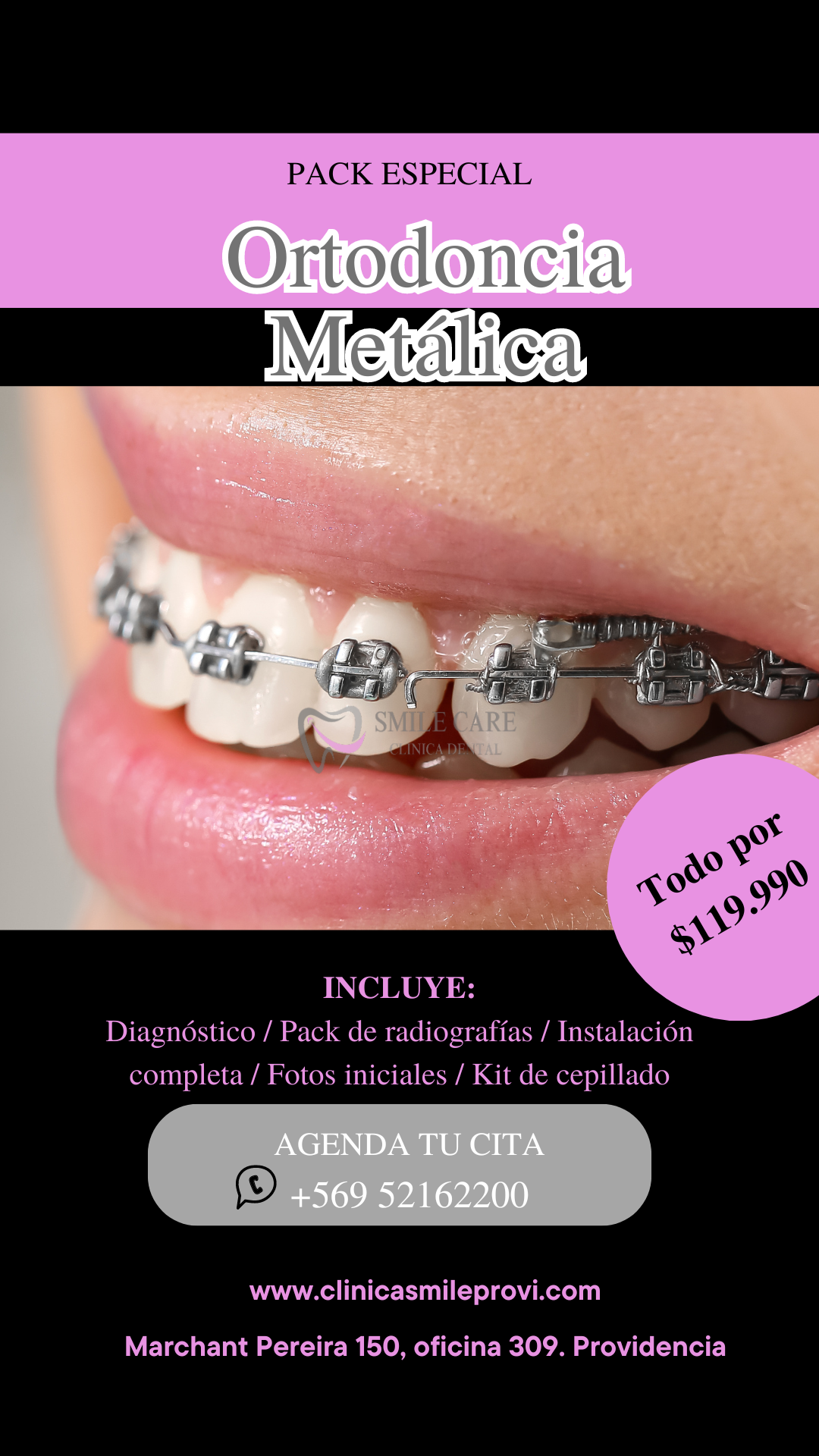 Pack Ortodoncia Metálica — $119.990 todo incluido